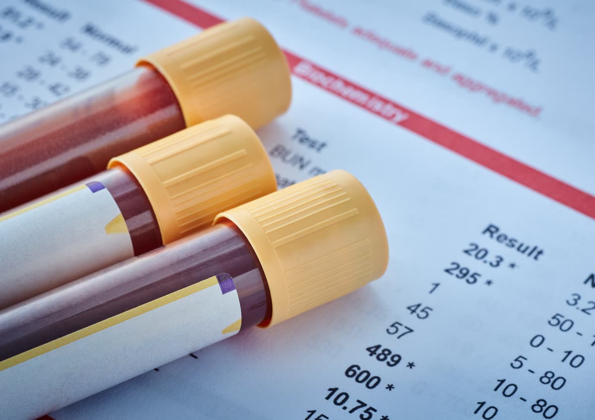 Private Blood Tests Southampton: Which Health Check Is Right for You?